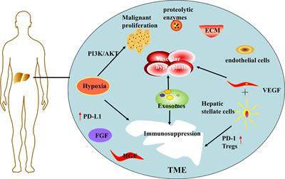 Feasibility of hepatocellular carcinoma treatment based on the tumor microenvironment